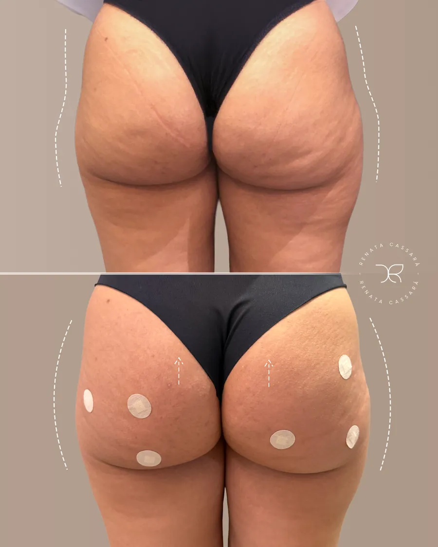 Antes e depois 1