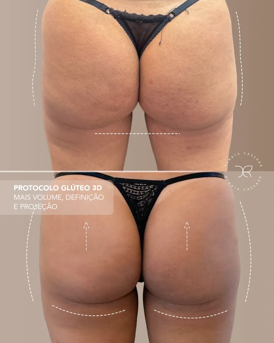 Antes e depois 3
