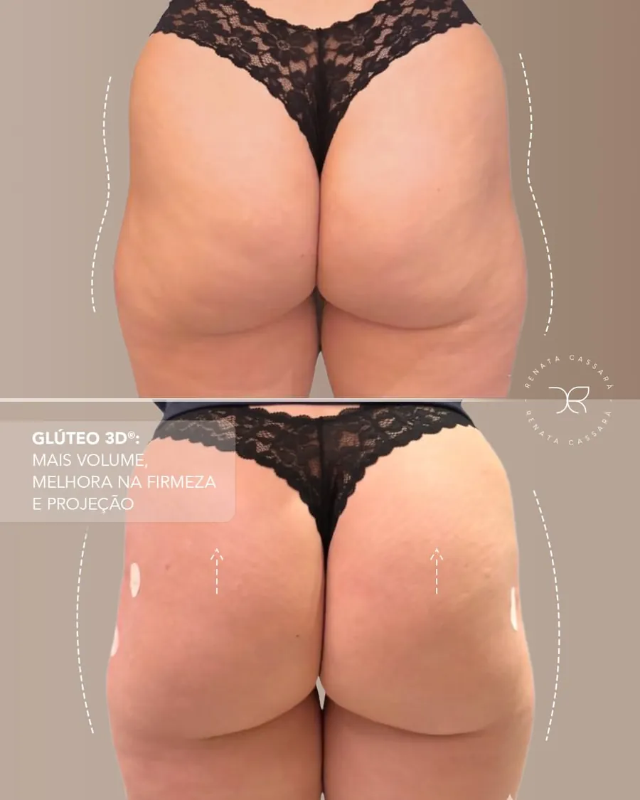 Antes e depois 5