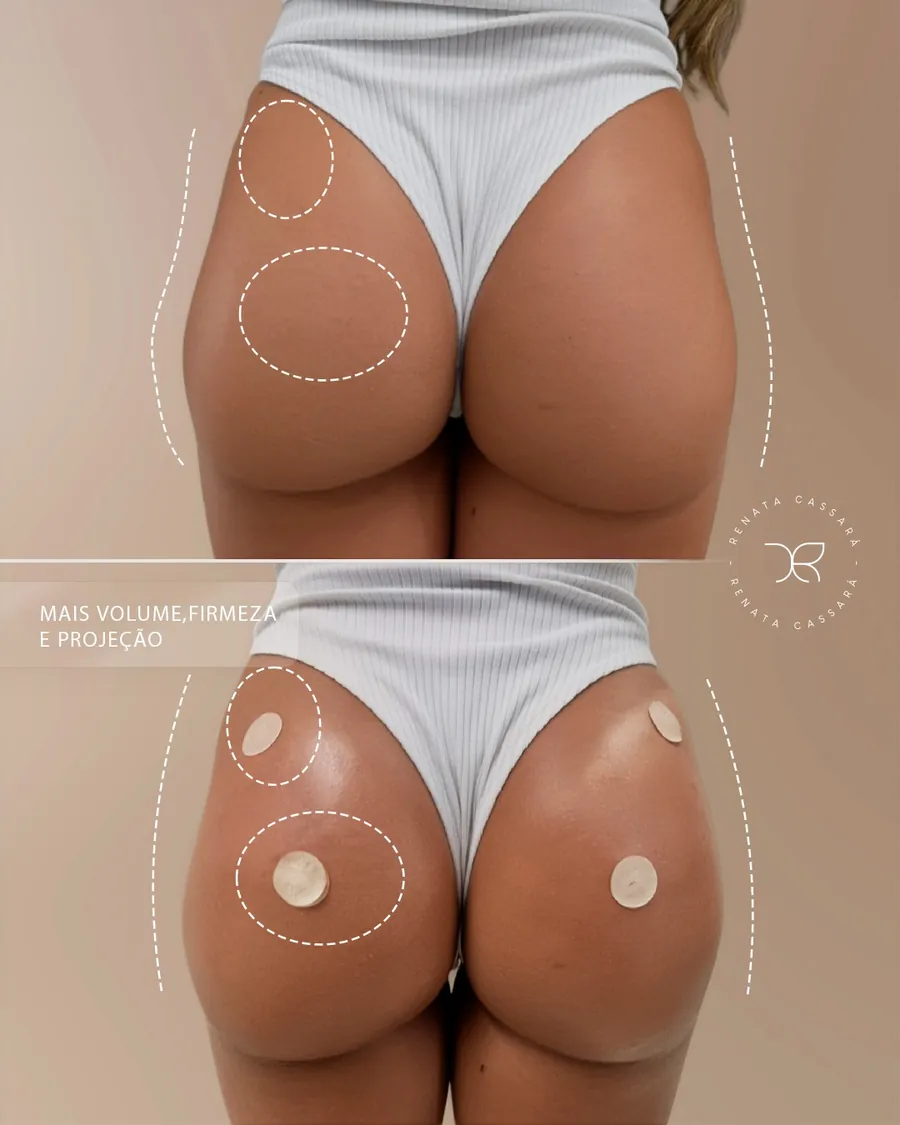 Antes e depois 6